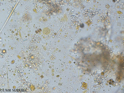 phyto/Pertuis Charentais/Tasdon_st2/PAMPAS 2019-2021/Stauridium tetras var. tetraodon (old Pediastum tetras var. tetraodon -TASDON_St2_R1_0719006).tif(copy)_thumb.jpg